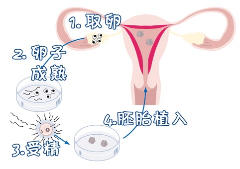 全球医疗